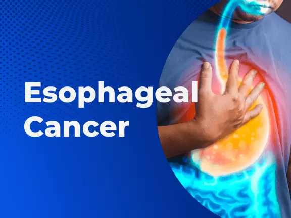 Esophageal Cancer